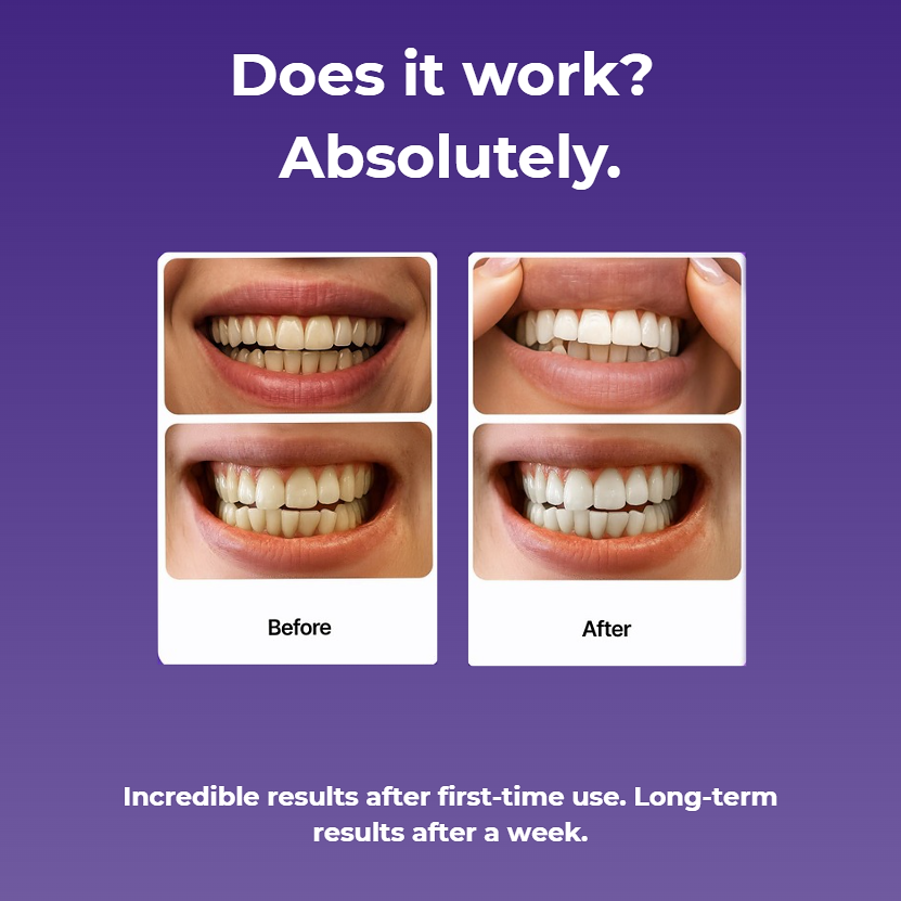 SmileyStrips - Purple Teeth Whitening Strips